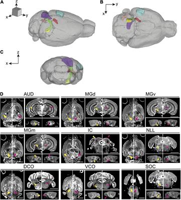 Volumetric analysis of the aging auditory pathway using high resolution magnetic resonance histology